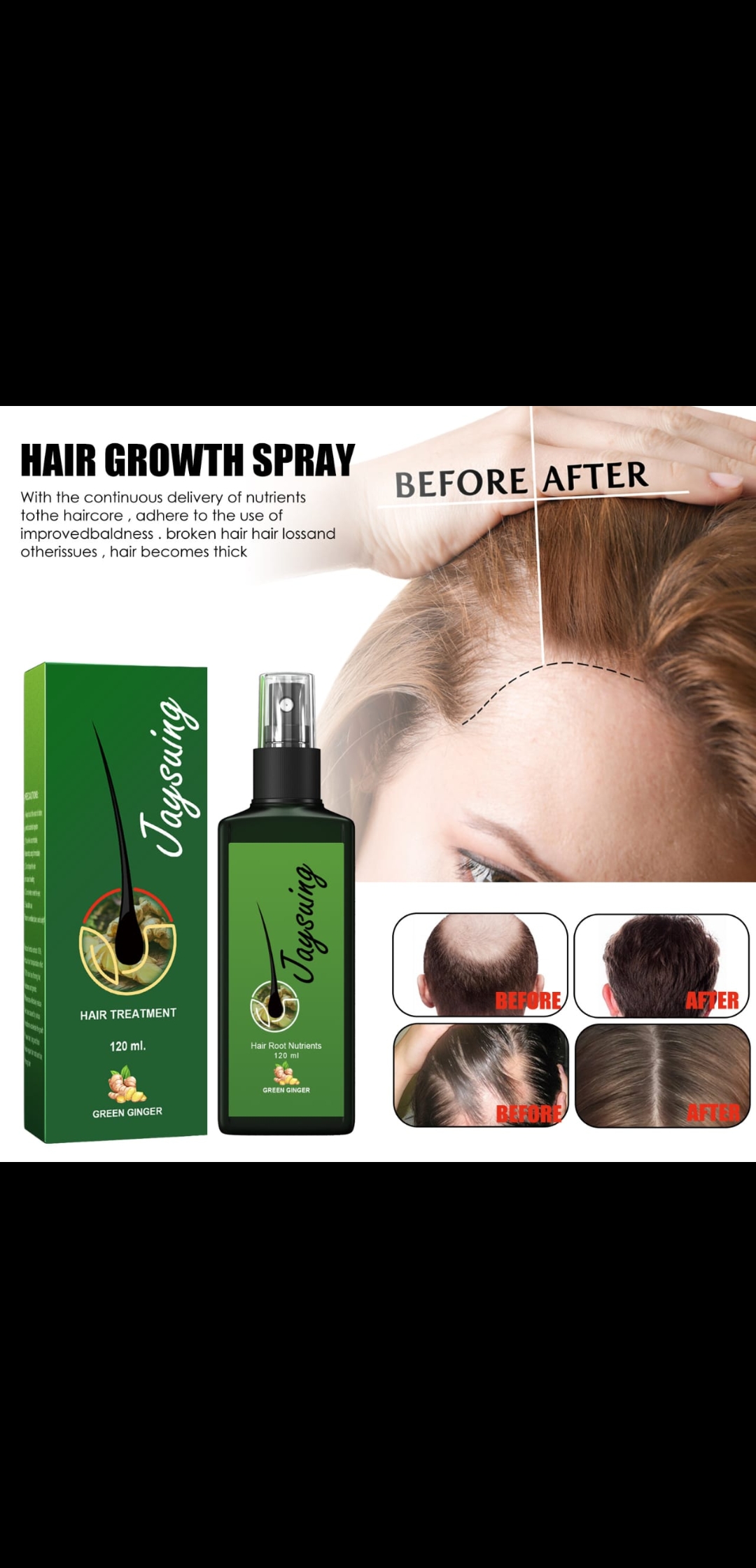 Hair growth spray